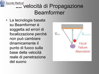 Socrate Medical presenta Zone Sonography, by Zonare