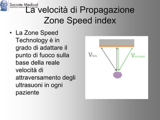 Socrate Medical presenta Zone Sonography, by Zonare