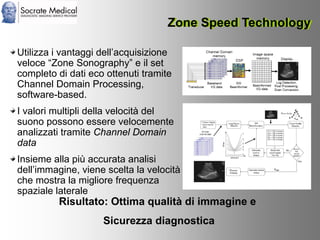 Socrate Medical presenta Zone Sonography, by Zonare