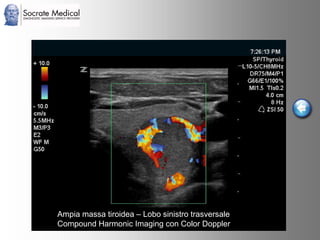 Socrate Medical presenta Zone Sonography, by Zonare