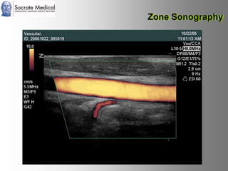 Socrate Medical presenta Zone Sonography, by Zonare