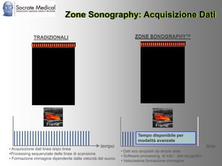 Socrate Medical presenta Zone Sonography, by Zonare