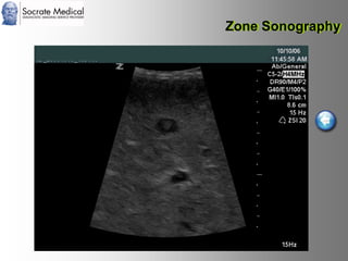 Socrate Medical presenta Zone Sonography, by Zonare