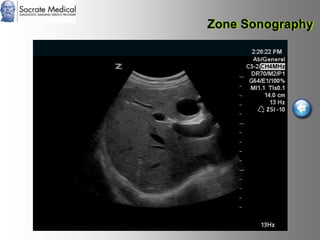 Socrate Medical presenta Zone Sonography, by Zonare