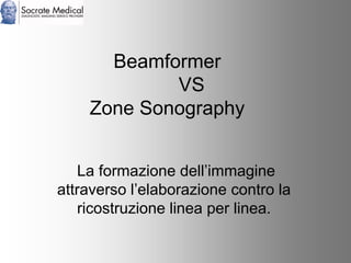 Socrate Medical presenta Zone Sonography, by Zonare