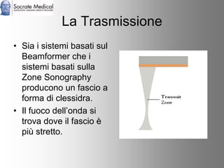 Socrate Medical presenta Zone Sonography, by Zonare