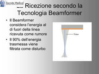Socrate Medical presenta Zone Sonography, by Zonare