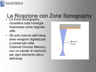 Socrate Medical presenta Zone Sonography, by Zonare