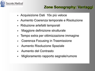 Socrate Medical presenta Zone Sonography, by Zonare
