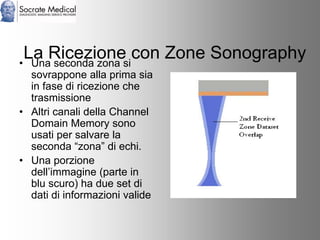 Socrate Medical presenta Zone Sonography, by Zonare