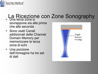 Socrate Medical presenta Zone Sonography, by Zonare