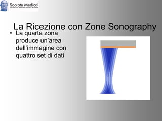 Socrate Medical presenta Zone Sonography, by Zonare