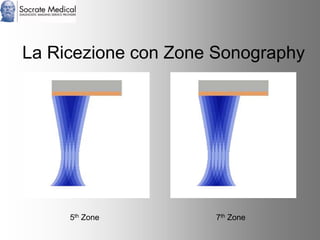 Socrate Medical presenta Zone Sonography, by Zonare