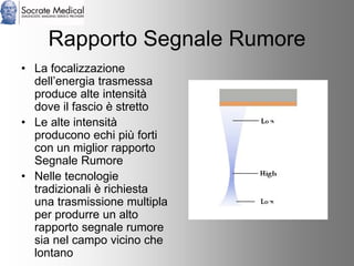 Socrate Medical presenta Zone Sonography, by Zonare