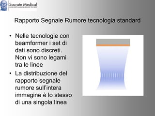 Socrate Medical presenta Zone Sonography, by Zonare