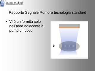 Socrate Medical presenta Zone Sonography, by Zonare