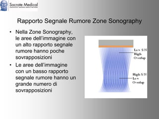 Socrate Medical presenta Zone Sonography, by Zonare