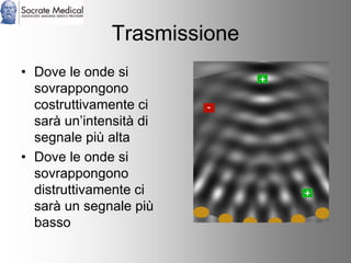Socrate Medical presenta Zone Sonography, by Zonare