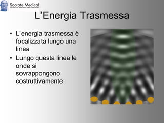 Socrate Medical presenta Zone Sonography, by Zonare