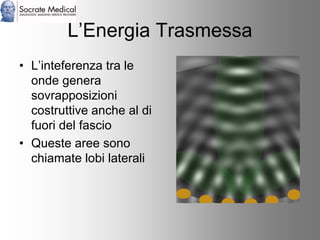 Socrate Medical presenta Zone Sonography, by Zonare