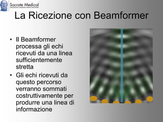 Socrate Medical presenta Zone Sonography, by Zonare