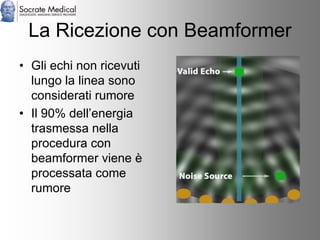 Socrate Medical presenta Zone Sonography, by Zonare