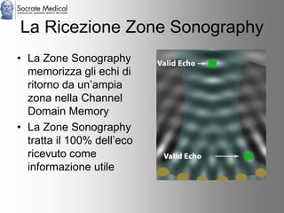 Socrate Medical presenta Zone Sonography, by Zonare