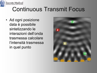 Socrate Medical presenta Zone Sonography, by Zonare