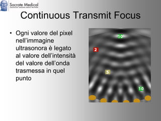 Socrate Medical presenta Zone Sonography, by Zonare