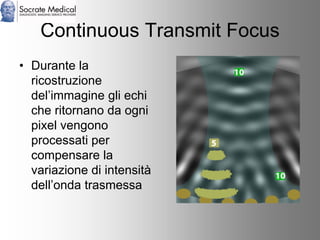 Socrate Medical presenta Zone Sonography, by Zonare