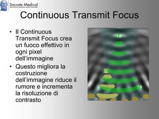Socrate Medical presenta Zone Sonography, by Zonare