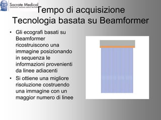 Socrate Medical presenta Zone Sonography, by Zonare