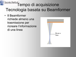 Socrate Medical presenta Zone Sonography, by Zonare