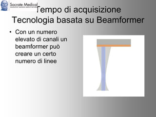 Socrate Medical presenta Zone Sonography, by Zonare