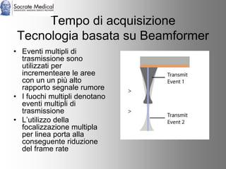 Socrate Medical presenta Zone Sonography, by Zonare