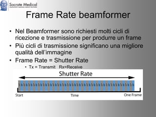 Socrate Medical presenta Zone Sonography, by Zonare