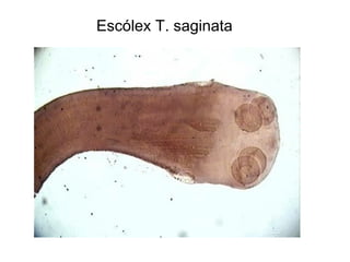 Escólex T. saginata 