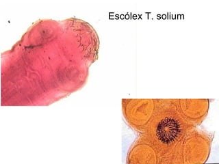 Escólex T. solium 