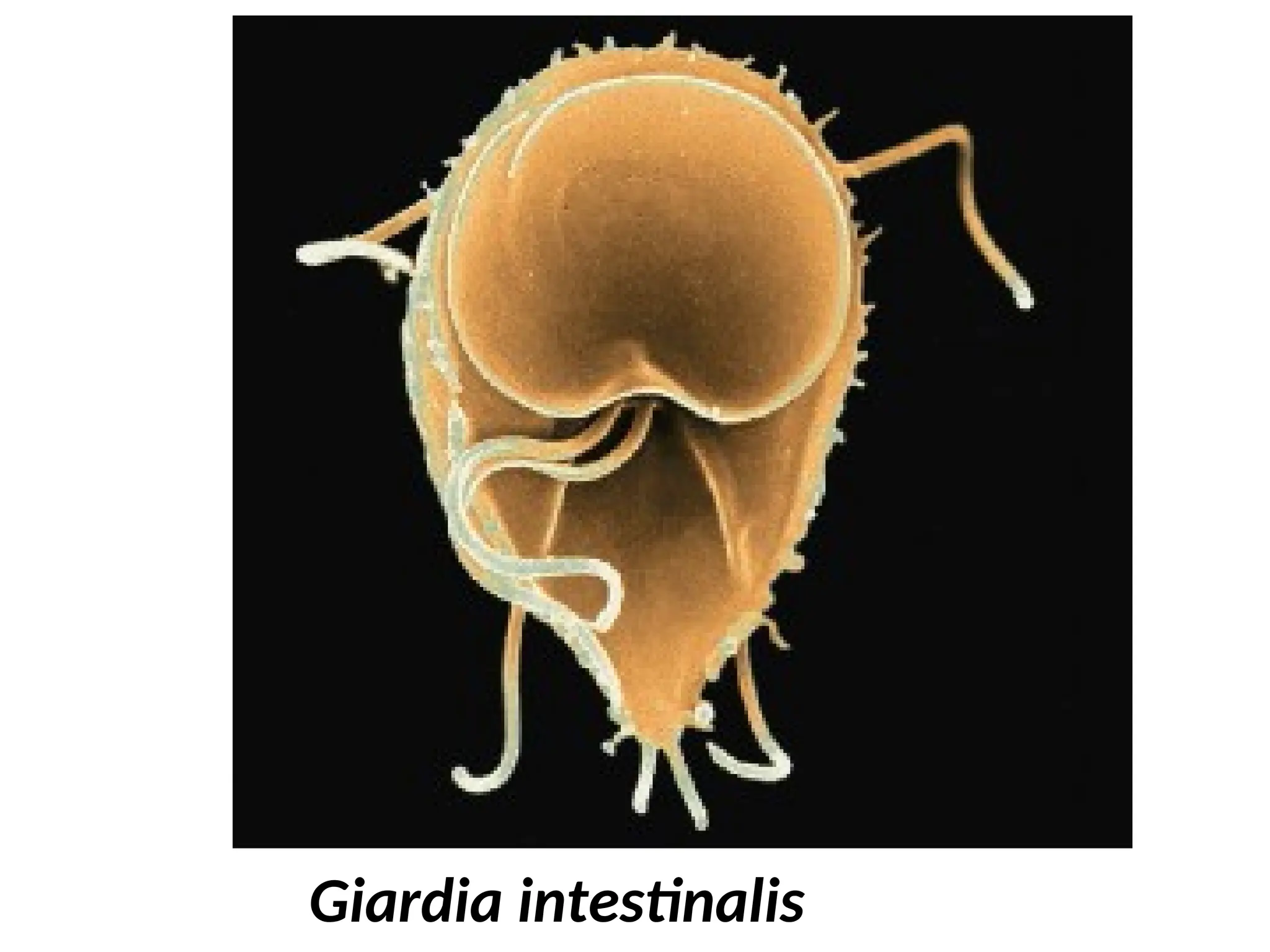 Giardia intestinalis
 