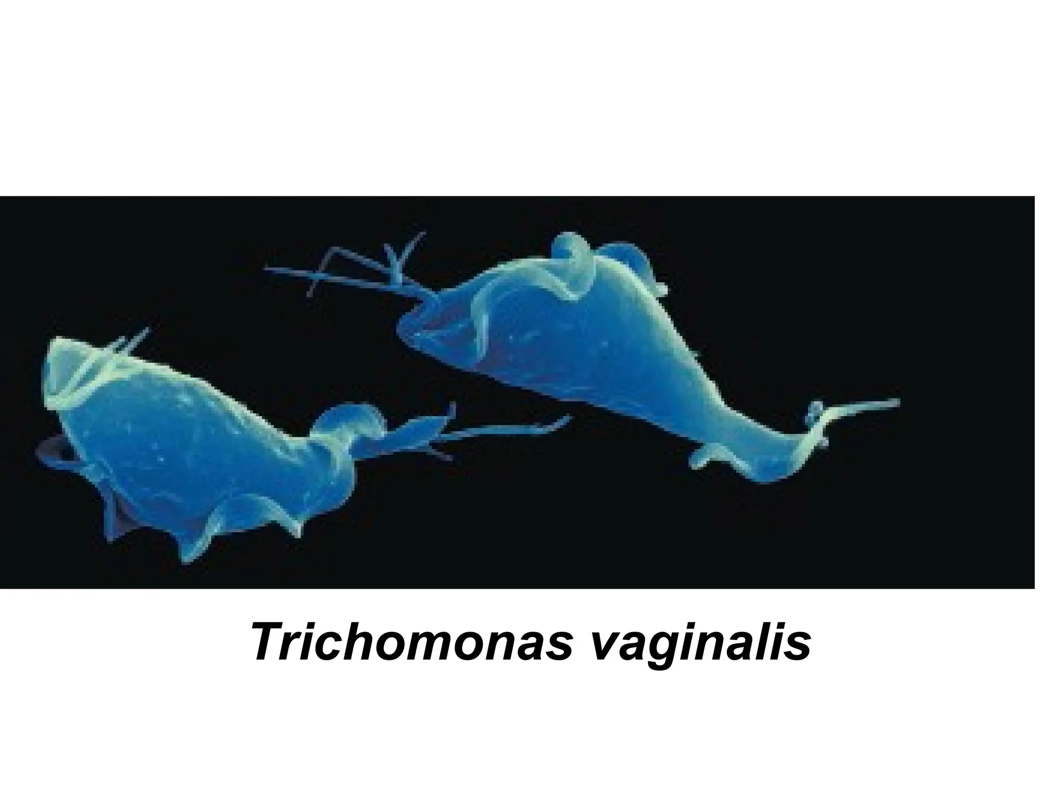 Trichomonas vaginalis
 