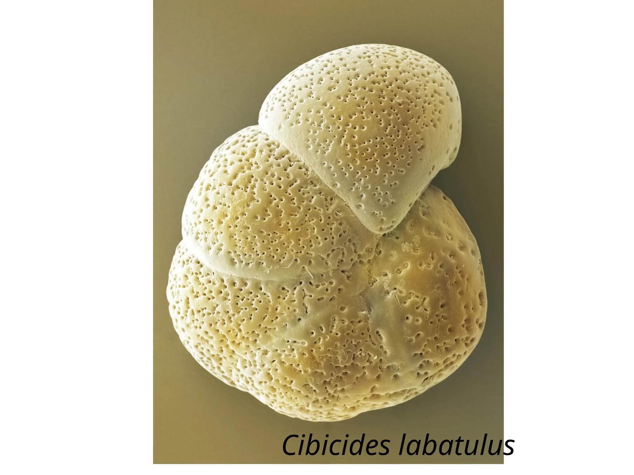 Cibicides labatulus
 