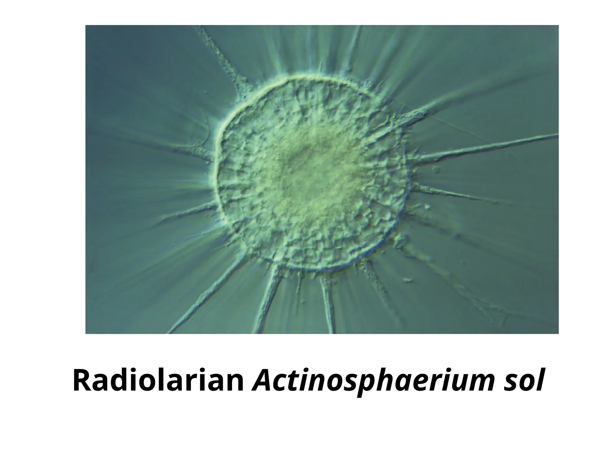 Radiolarian Actinosphaerium sol
 