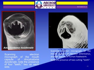 Mr Ibrahim A. G
Scanning electron
micrograph of the mouth
capsule of Ancylostoma
duodenale, note the presence
of four "teeth," two on each
side.
Scanning electron micrograph of the
mouth capsule of Necator americanus,
another species of human hookworm.
Note the presence of two cutting "teeth“.
20
 