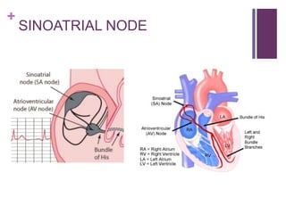 +
SINOATRIAL NODE
 