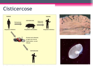 Cisticercose 