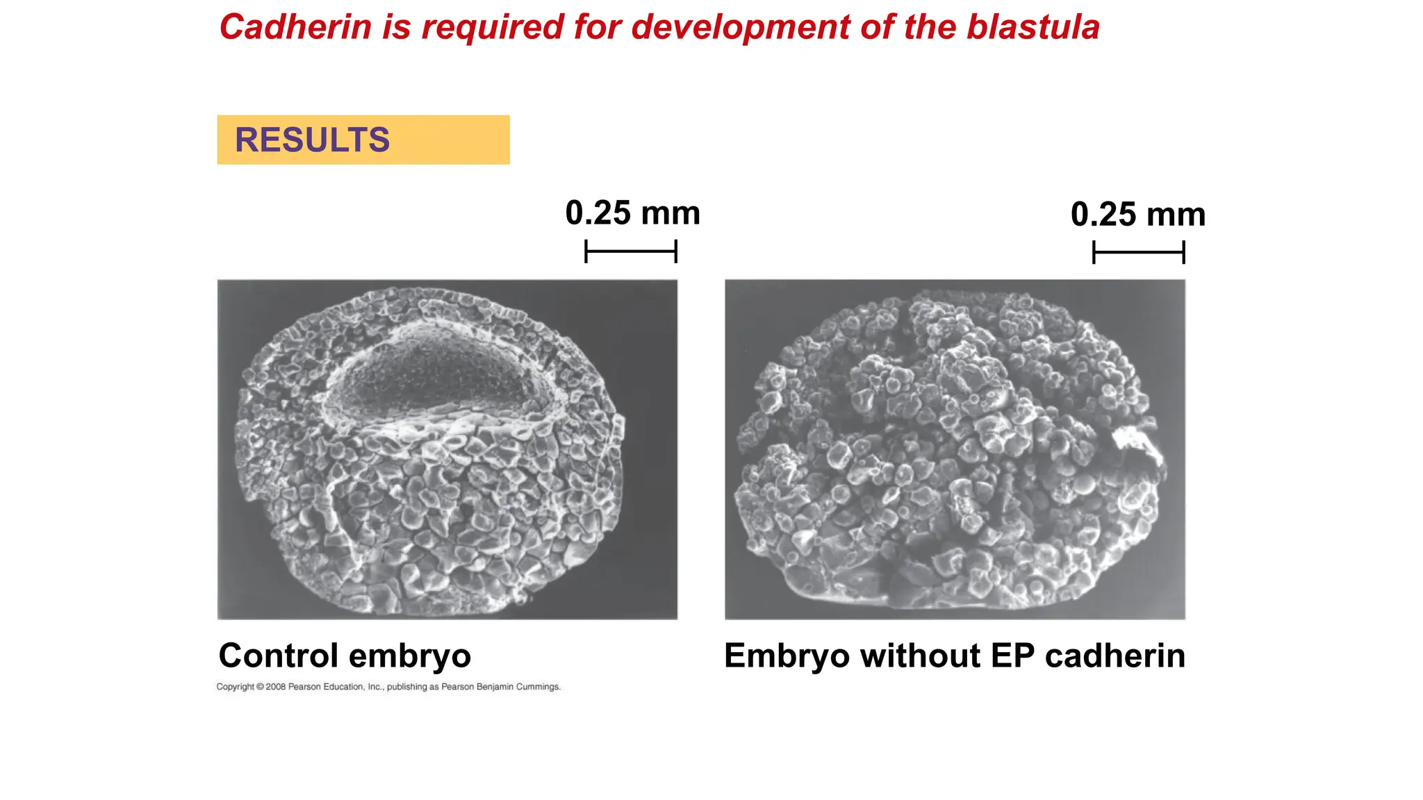 Cadherin is required for development of the blastula
Control embryo Embryo without EP cadherin
0.25 mm 0.25 mm
RESULTS
 