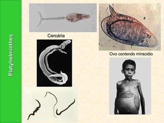 Platyhelminthes Cercária Ovo contendo míracidio   