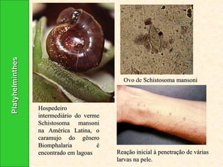 Hospedeiro intermediário do verme Schistosoma mansoni na América Latina, o caramujo do gênero Biomphalaria é encontrado em lagoas Ovo de  Schistosoma mansoni   Reação inicial à penetração de várias larvas na pele. Platyhelminthes 