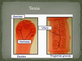 Tenia
 