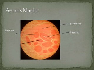 pseudocele
intestino
testiculo
 